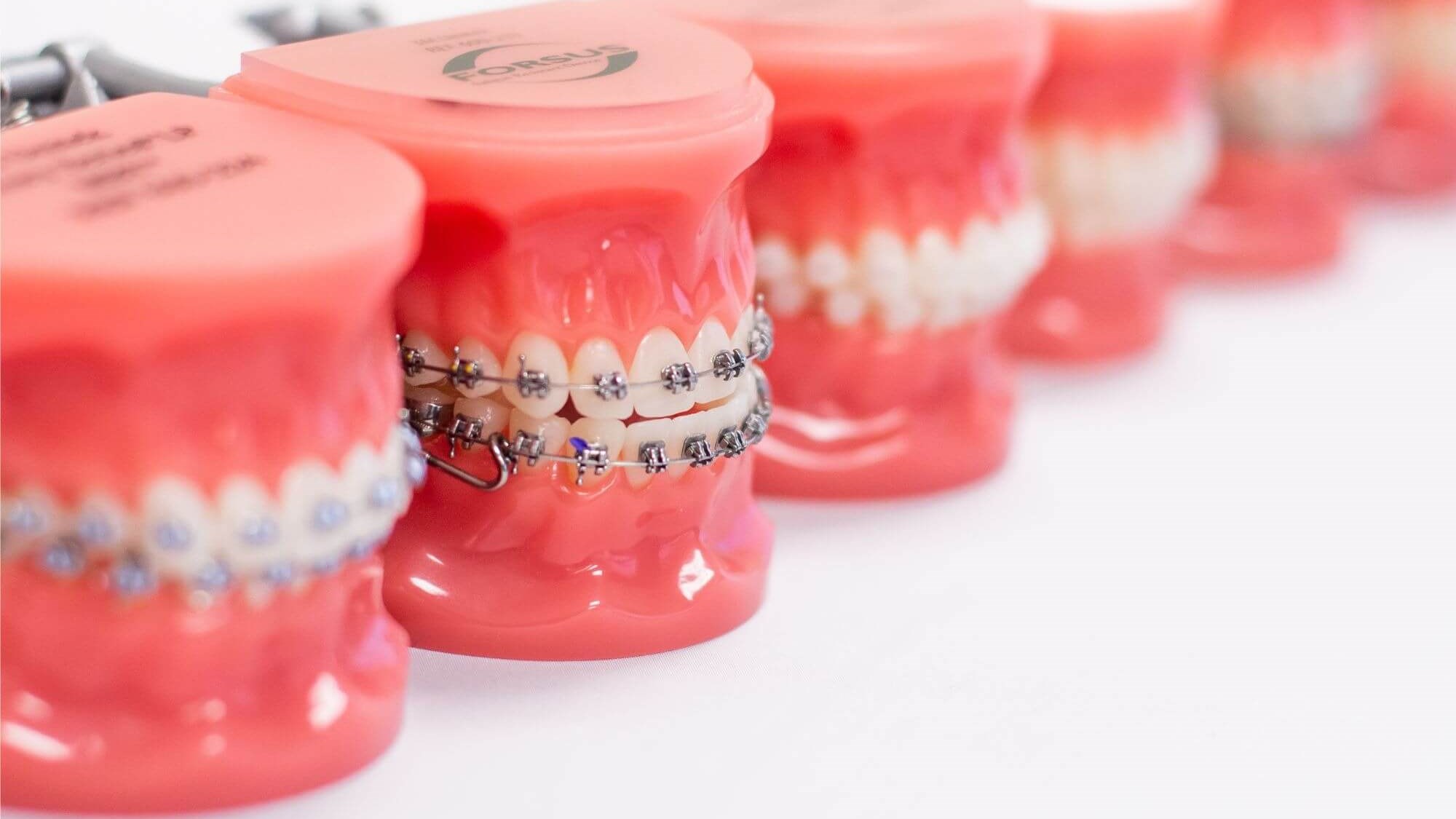 Braces on Teeth